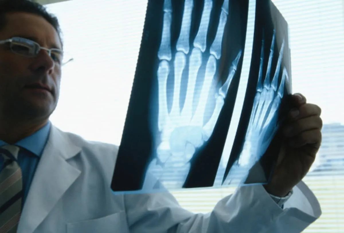 osteoporosis 8 consejos