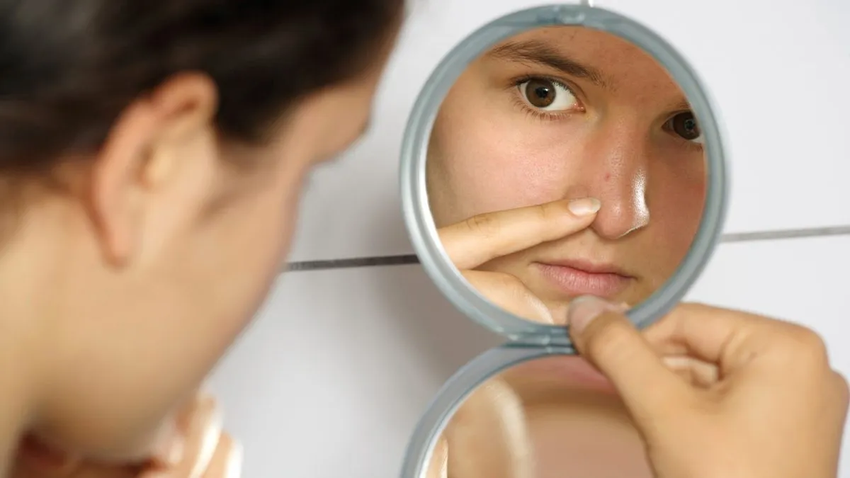 Como tratar el acne