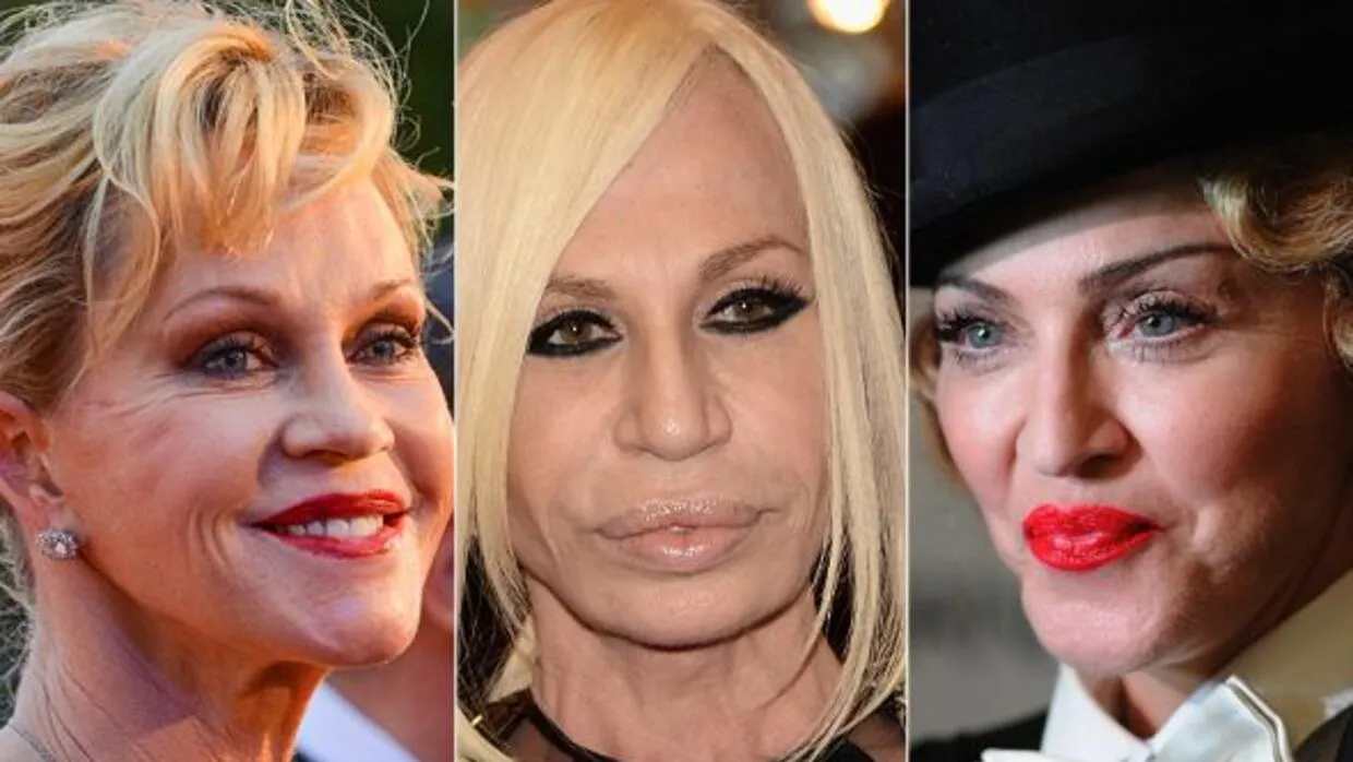 Famosas antes y después del botox