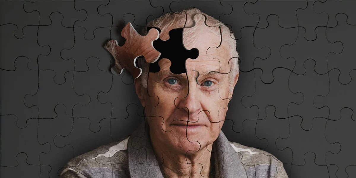 alzheimer