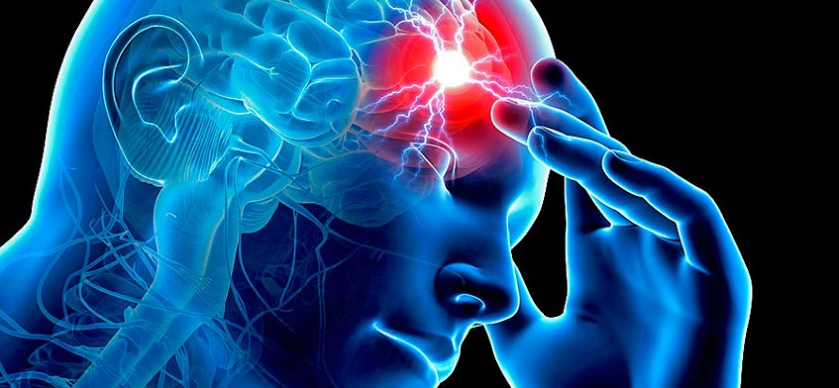 Ictus o infarto cerebral: los signos de alerta que salvan tu vida ...