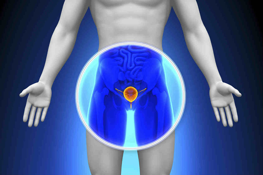¿A qué edad hay que hacerse estudios para la detección de cáncer de próstata? 4 ¿A qué edad hay que hacerse estudios para la detección de cáncer de próstata? 2