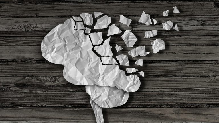 El nuevo test para saber si padece Alzheimer o Parkinson