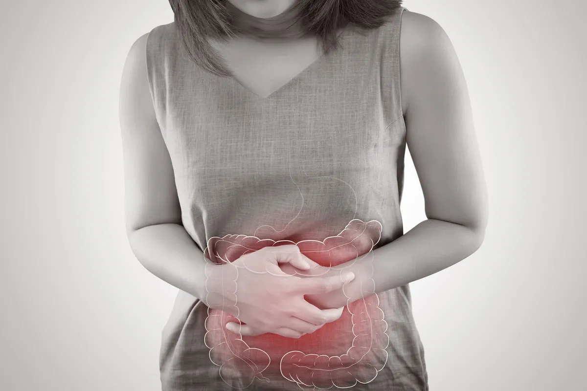 colon irritable