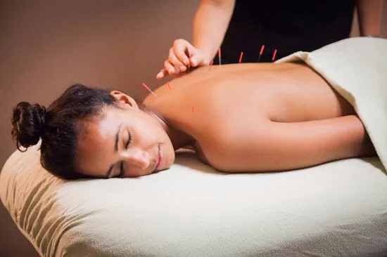 acupuntura para dormir mejor