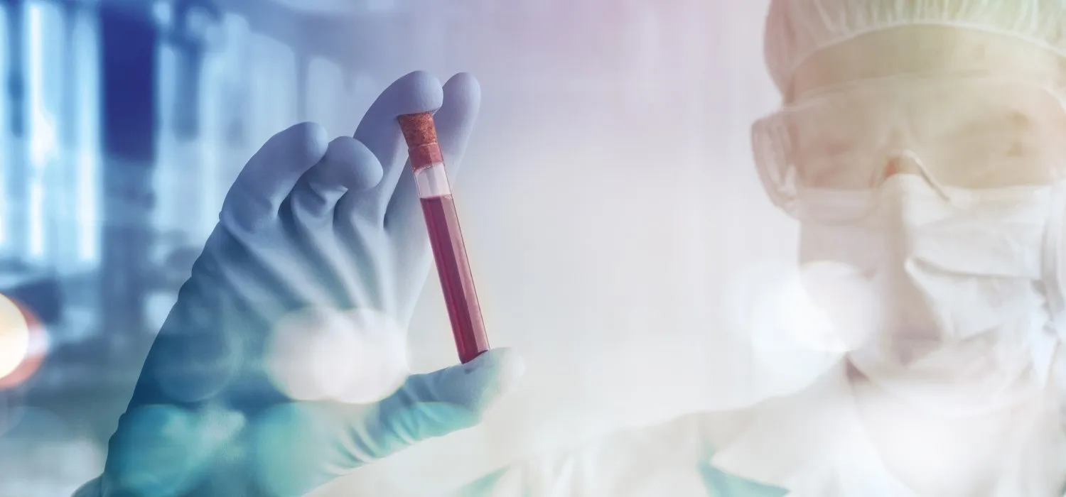 Biopsia líquida: ¿nuevo procedimiento para descubrir un cáncer?