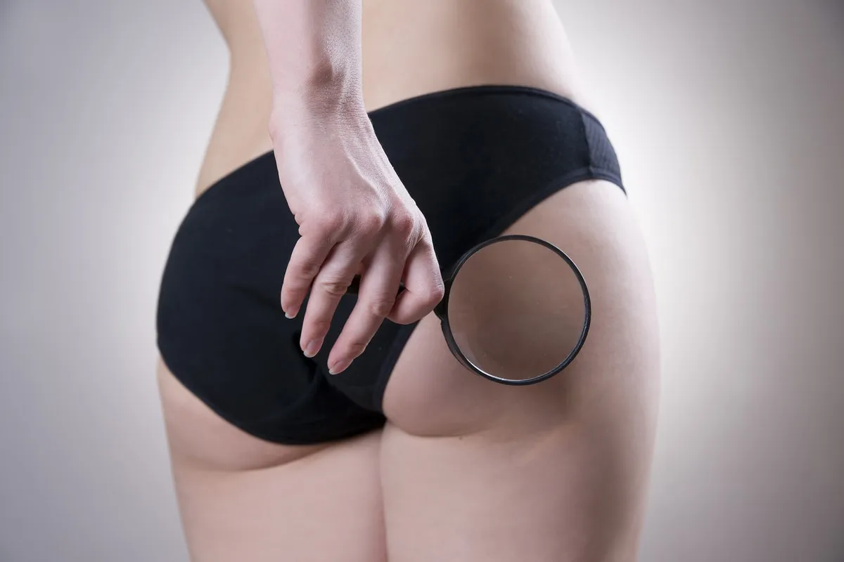 Tratamiento para celulitis