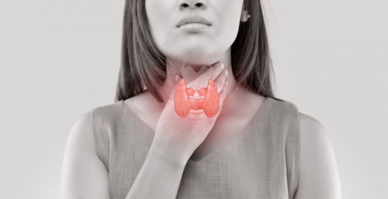 Qué es el hipotiroidismo síntomas