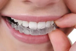 Brackets removibles