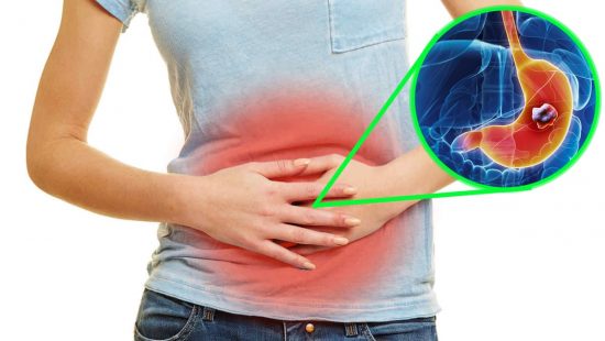 Dolor abdominal y problemas digestivos Mujer con dolor abdominal sujetándose el vientre, acompañado de ilustración del estómago para representar problemas digestivos.