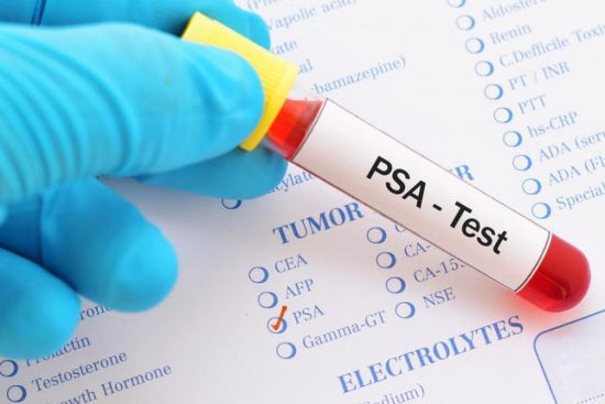 Cáncer de próstata: el más común entre los hombres, el menos hablado 2 cancer de prostata diagnóstico