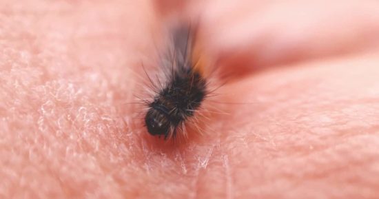 Picadura de pulga: cómo identificarla y qué hacer 9
