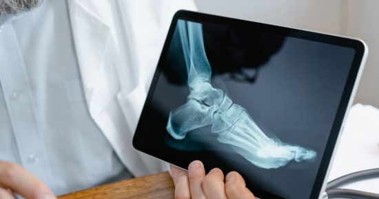 ¿Se pueden curar los huesos más rápido ante una fractura? 11 ¿Se pueden curar los huesos más rápido ante una fractura? 11