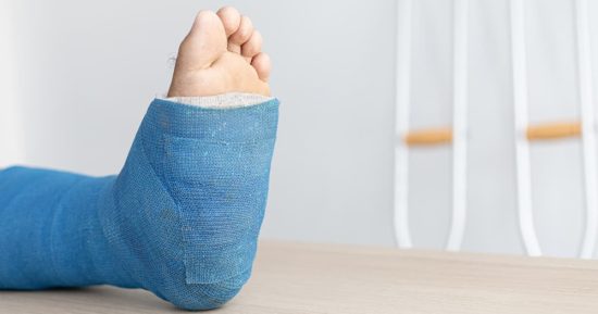¿Se pueden curar los huesos más rápido ante una fractura? 13 ¿Se pueden curar los huesos más rápido ante una fractura? 13
